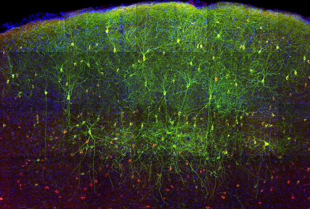 Fr die Wissenschaft noch undurchschau...mmenarbeit im Netzwerk der Hirnzellen   | Foto: mpg