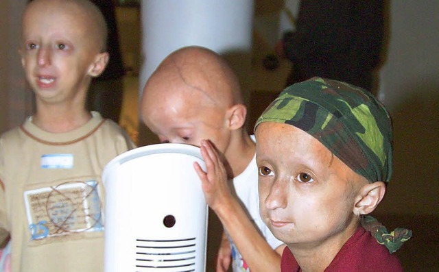 Schon nach wenigen Lebensmonaten sehen Progeriekinder uralt aus  | Foto: BZ