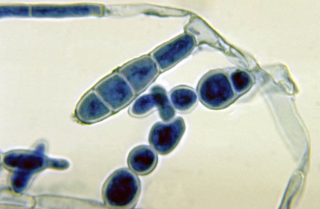 Hautpilzzellen (Epidermophyton floccosum) unter dem Mikroskop.   | Foto: wikimedia
