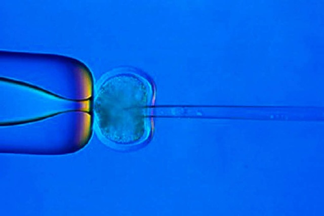 Die Chromosomen im Zellkern einer Eizelle werden entfernt.   | Foto: DDP