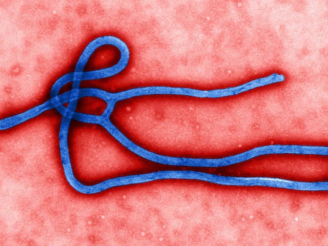 Bislang tritt das Ebola-Virus nur in Afrika auf.  | Foto: AFP