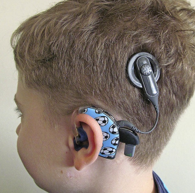 Mike Schmer zeigt sein Cochlea Implantat.   | Foto: privat