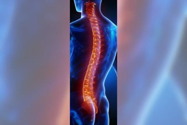 Rückenschmerzen verursachen jede zehnte Krankschreibung