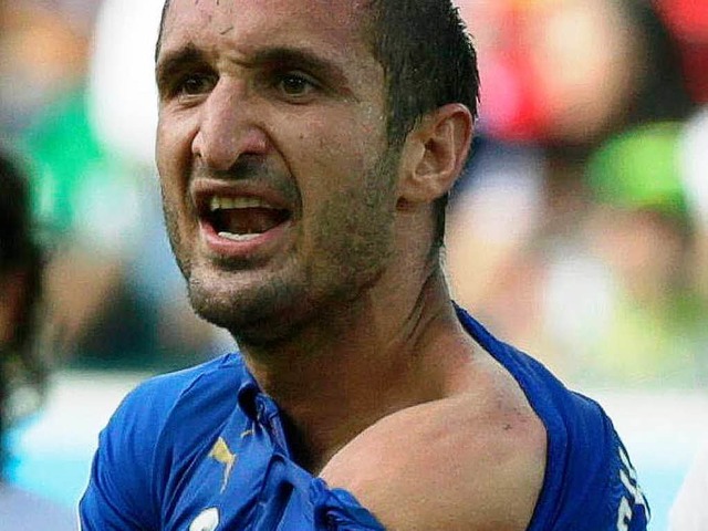 Giorgio Chiellini zeigt seine Biss-Wunde.   | Foto: dpa