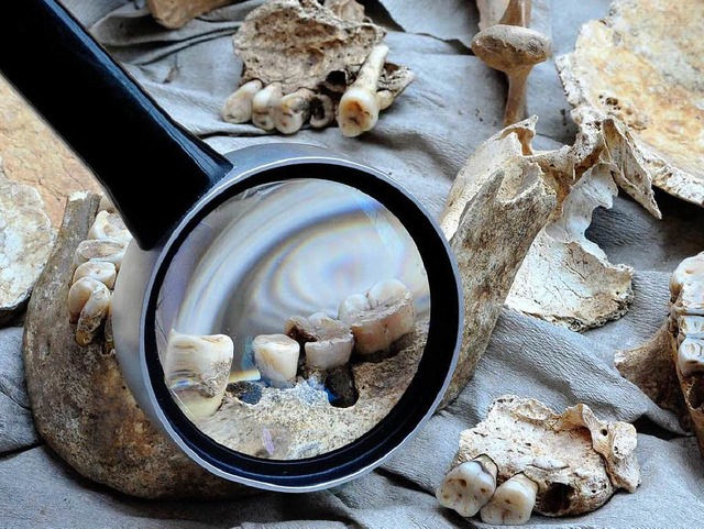 Spuren einer Entzndung an der Zahnwur...#8211; Jahrhunderte zu spt entdeckt.   | Foto: Thomas Kunz