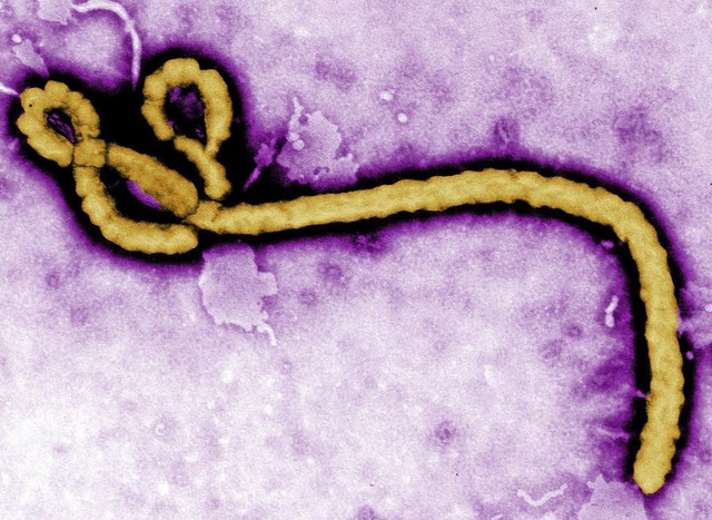Ebola-Virus  | Foto: dpa