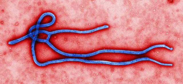 Harmloser Anblick: eingefrbte Elektronenmikroskop-Aufnahme eines Ebola-Virus   | Foto: dpa