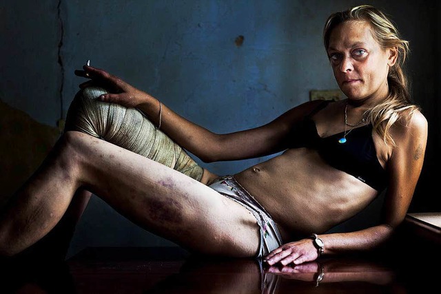 Das unverschleierte Gesicht von HIV: F...Stirton den World Press Photo Contest.  | Foto: dpa