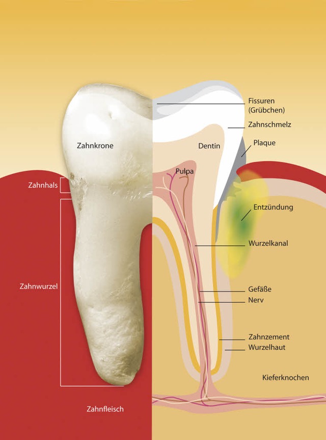 Zahnfleisch entzndet sich schleichend... in diesem Zustand lange schmerzfrei.   | Foto: Pro Dente