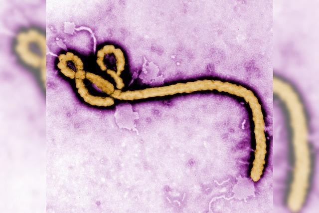 Zweiter Ebola-Fall in USA