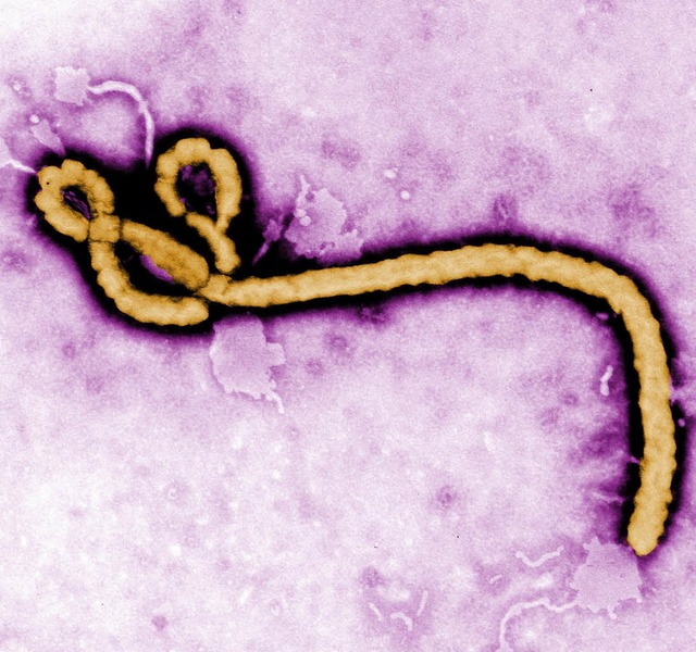 Das Ebola-Virus hlt die Welt in Atem.   | Foto: dpa