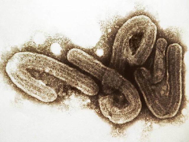 Ebola-Viren: Ihnen hat die Wissenschaft den Kampf angesagt.  | Foto: Markus Beck
