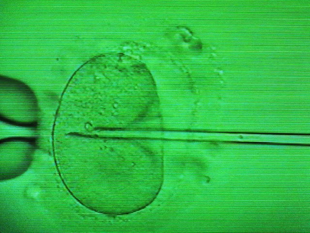 Das Monitorfoto zeigt die Injektion ei...e in eine Eizelle mittels Mikropipette  | Foto: dpa