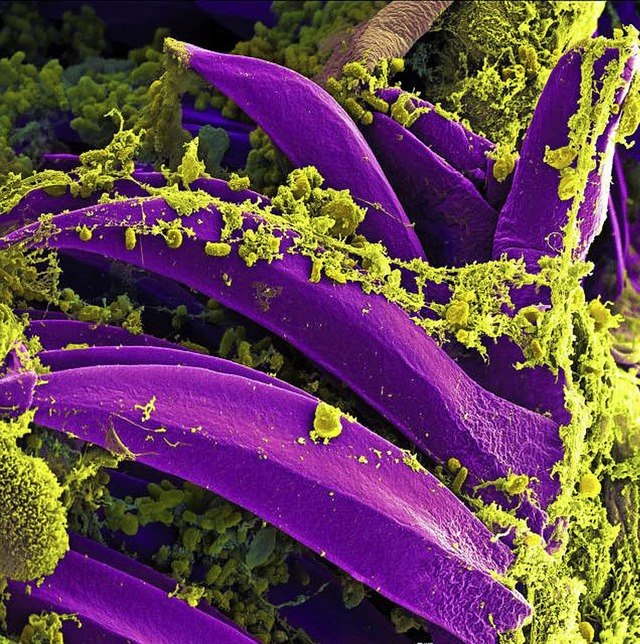 Yersinia-pestis-Bakterien  | Foto: dpa