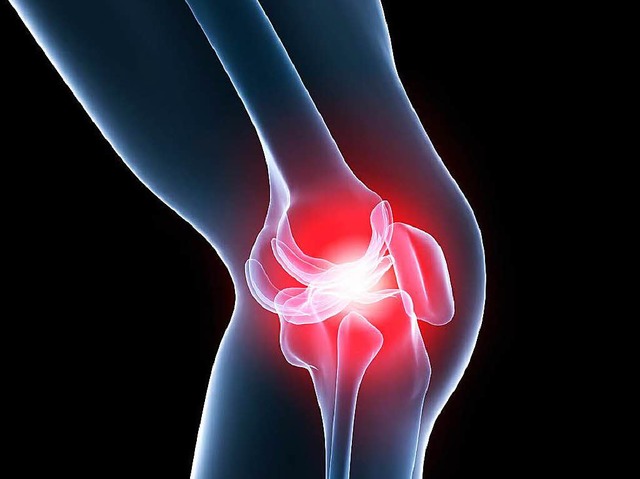 Probleme mit Knie (Foto), Hfte und H...n des &#8222;Gesundheitsforums&#8220;.  | Foto: fotolia.com/sebastian kaulitzki