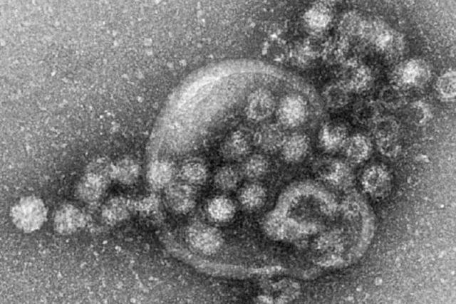 Norovirus an Grenzacher Schule – ganzes Gebude wird desinfiziert