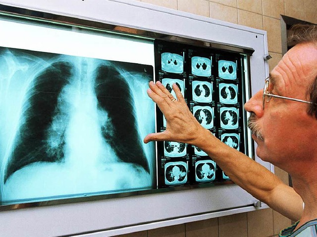 Rntgenbild einer Lunge  | Foto: Jan-Peter Kasper