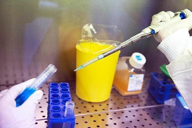 Impfstoff gegen Ebola: Tests aus Tübingen sind vielversprechend