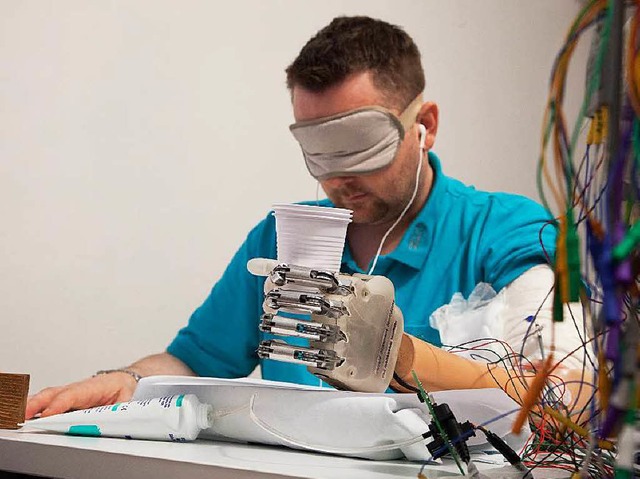 Nur der Anfang? Dennis Srensen  mit seiner fhlenden Handprothese  | Foto: Uni FREIBURG
