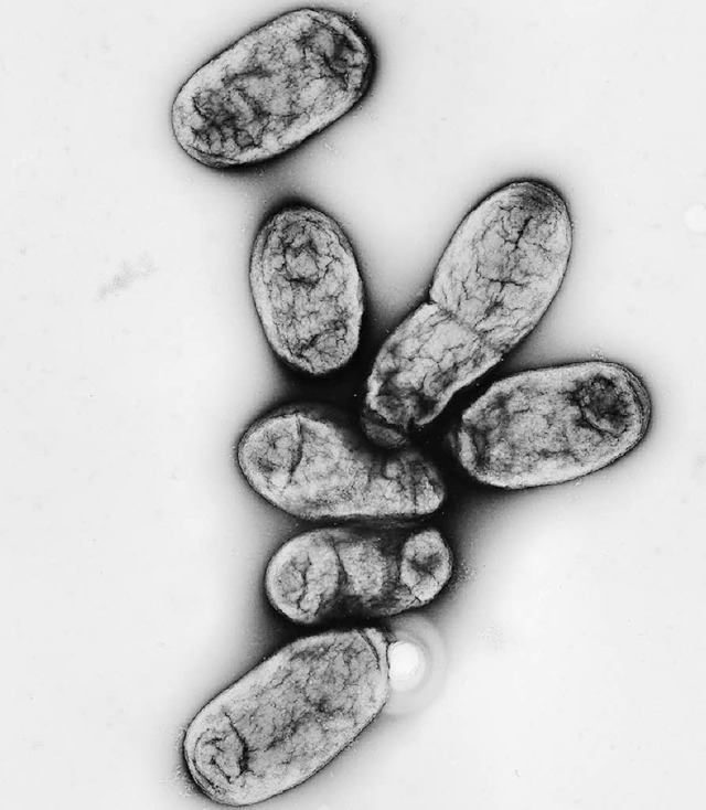 Gefhrlich: Yersinia pestis   | Foto: dpa
