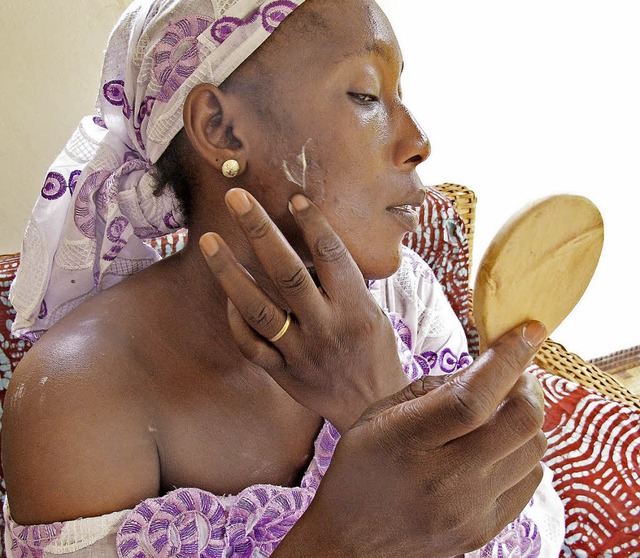 Bintou Dembele aus Mali bleicht sich die Haut.   | Foto: dpa