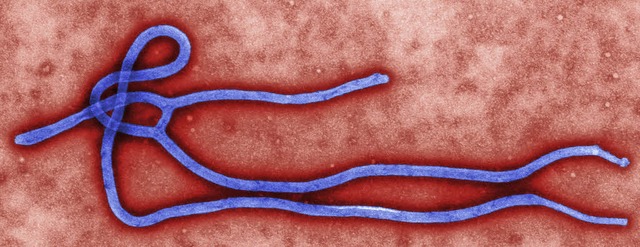 Forscher glauben das Virus (unten) unter Kontrolle zu haben.   | Foto: dpa/AFP