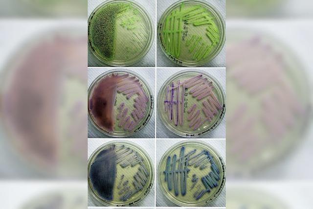 Langsam wachsende Bakterien knnen Infektionen immer wieder anfachen