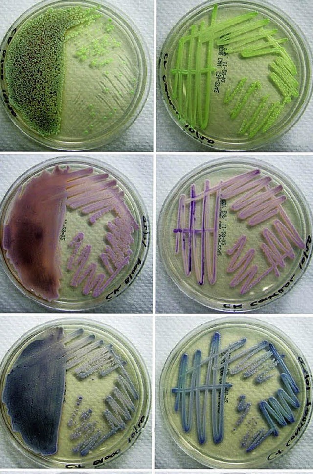 Resistent oder tolerant? Bakterien in der Schale    | Foto: Humboldt-Universitt
