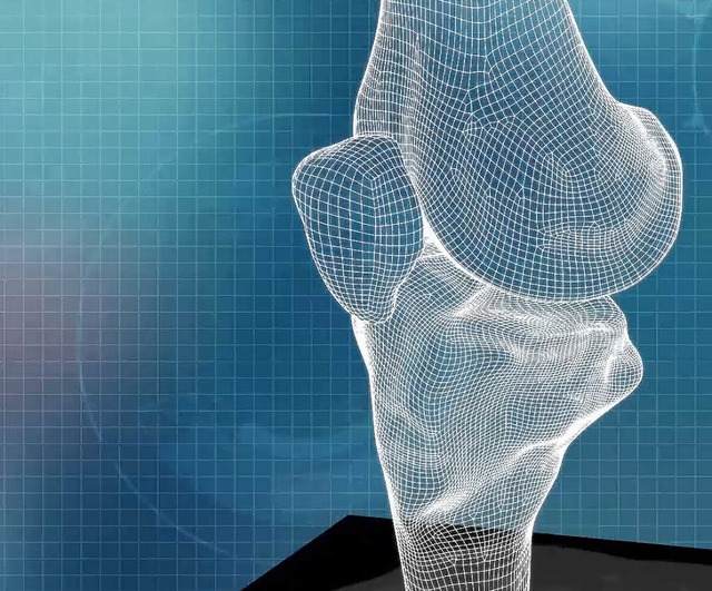 Dreidimensionale Darstellung eines Kni...der Prothesenentwurf fr den Drucker.   | Foto: Fotos: Conformis
