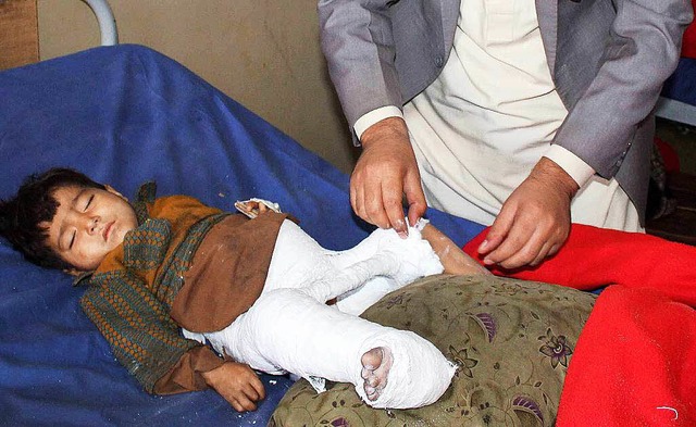 Dieser Junge wurde beim Erdbeben in Pakistan schwer verletzt.  | Foto: dpa