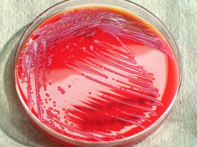 Das Bakterium &#8222;Serratia marcescens&#8220; in einer Petrischale.  | Foto: dpa