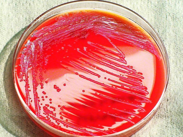 Das Bakterium (Serratia marcescens)  | Foto: dpa