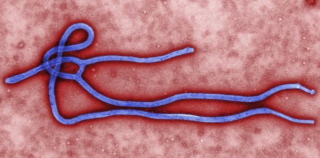 Ebola-Virus  | Foto: dpa