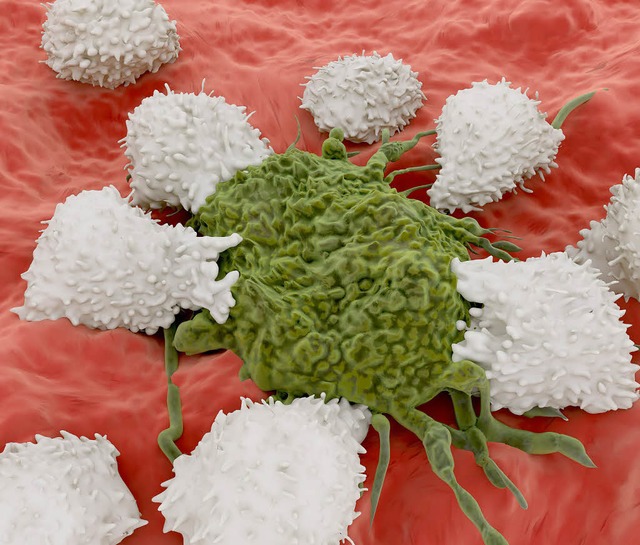 Weg damit: Zellen des Immunsystems greifen eine Krebszelle an.   | Foto: Juan Grtner (Fotolia.com)/dpa