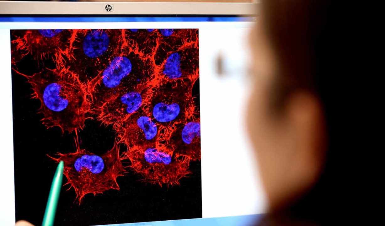 Monitorbild mit Melanom-Zellen (schwar...lichen Krebsarten zur Sprache kommen.   | Foto: dpa