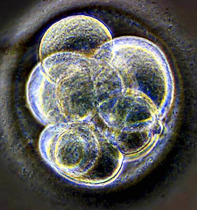 Ein drei Tage alter Embryo   | Foto: DPA