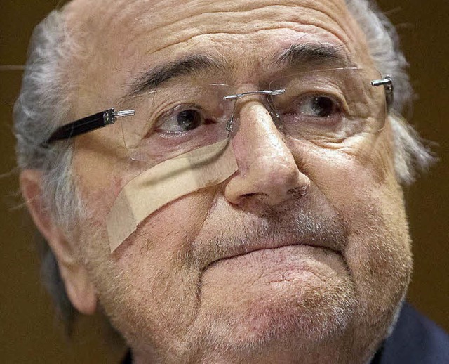Strubbelig und stoppelig: Der neue Sepp Blatter    | Foto: dpa
