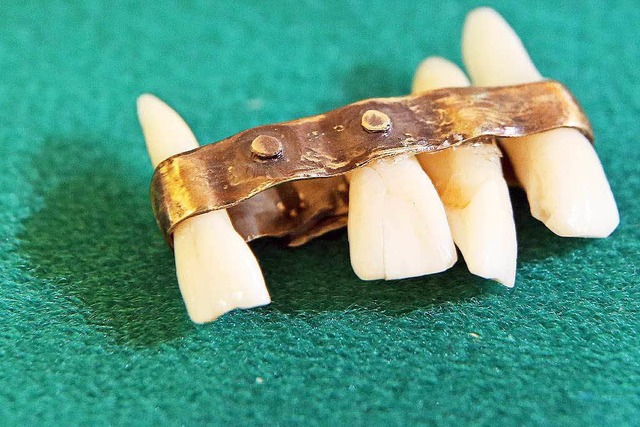 Ein etruskischer Zahnersatz mit einem ... auch er ist im Dentalmuseum zu sehen.  | Foto: dpa