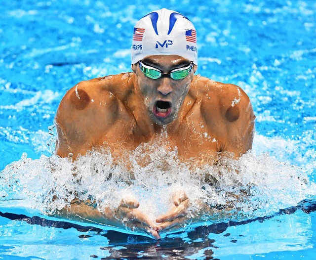 Die kreisrunden Flecken sind deutlich ...ar Michael Phelps lsst sich schrpfen  | Foto: dpa
