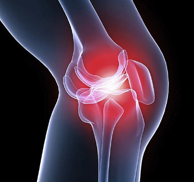 Schmerzen im Knie?  | Foto: Fotolia