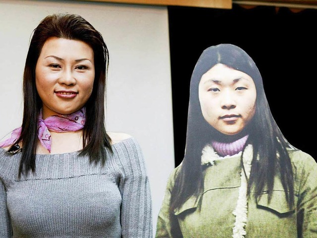 Nachher, vorher: Diese Chinesin lie i...perieren (rechts vor den Operationen)   | Foto: DPA
