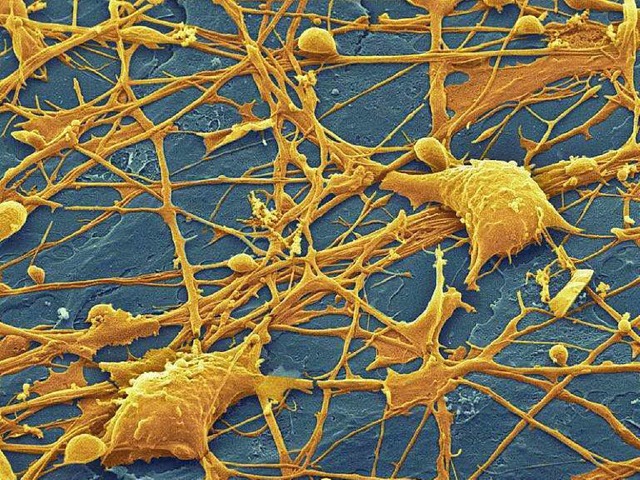 Nervenzellen und die Strnge, die sie verbinden  | Foto: -