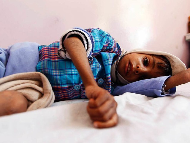 Ein unterernhrter  Junge im Jemen  | Foto: AFP