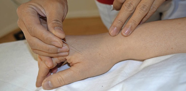 Akupunktur ist eine klassische Behandl...m Zentrum fr Komplementrmedizin an.   | Foto: Wieschenkmper