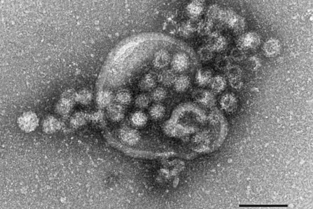 Norovirus breitete sich in Grundschule Schuttern aus