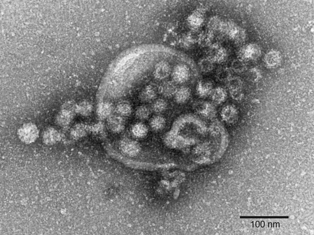 Das Norovirus unter dem Mikroskop  | Foto: Gudrun Holland/RKI