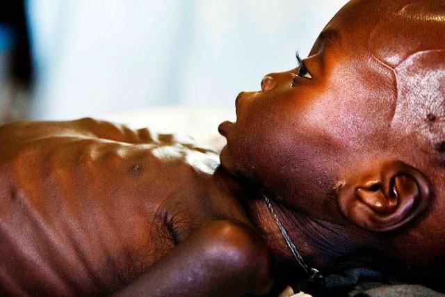 UNO warnt: 1,4 Millionen Kinder sind vom Tod bedroht
