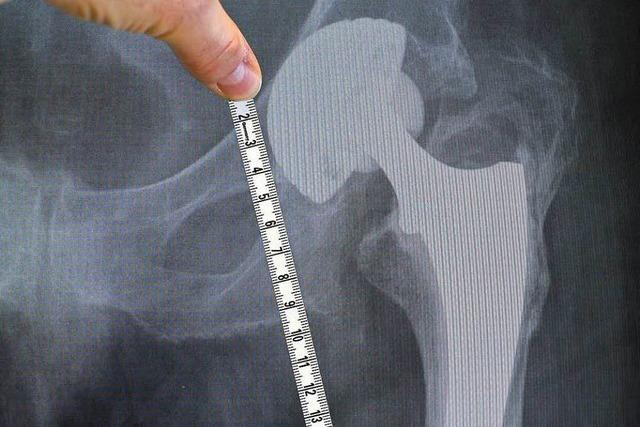 Patientin erhält Schmerzensgeld wegen fehlerhafter Hüftprothese