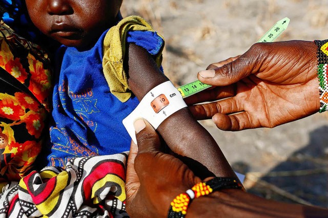 Im Sdsudan leidet die Bevlkerung an ...kte in dem jungen Land nicht aufhren.  | Foto: dpa