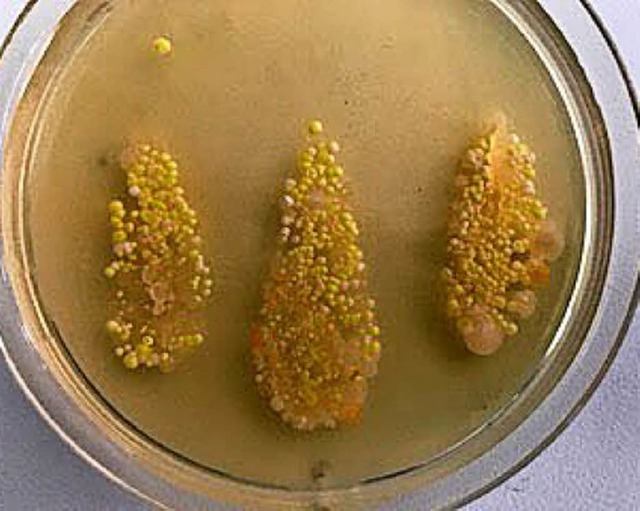 So sehen gezchtete Bakterienkolonien ...us. Man sieht die Fingerabdrcke  gut.  | Foto: privat